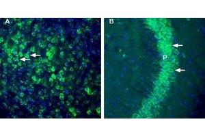 Expression of thromboxane A2 receptor in mouse cortex and hippocampus - Immunohistochemical staining of perfusion-fixed frozen mouse brain sections with Anti-Thromboxane A2 Receptor Antibody (ABIN7043809, ABIN7045124 and ABIN7045125), (1:200), followed by goat anti-rabbit-AlexaFluor-488.