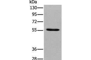 Western blot analysis of Human pancreas tissue using GPC4 Polyclonal Antibody at dilution of 1:500 (GPC4 anticorps)