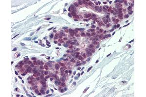 Anti-PCBP1 antibody IHC of human breast. (PCBP1 anticorps  (AA 208-257))