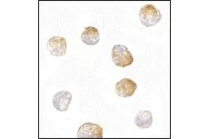 Immunohistochemistry (IHC) image for anti-BCL2-Like 11 (Apoptosis Facilitator) (BCL2L11) (AA 2-198) antibody (ABIN492531)