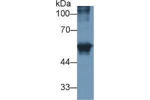 Detection of CEACAM1 in Human HepG2 cell lysate using Polyclonal Antibody to Carcinoembryonic Antigen Related Cell Adhesion Molecule 1 (CEACAM1) (CEACAM1 anticorps)