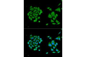 Immunofluorescence analysis of MCF-7 cells using DDX58 antibody. (DDX58 anticorps)