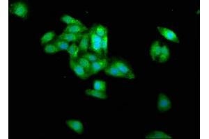 Immunofluorescence staining of HepG2 cells with ABIN7159237 at 1:266, counter-stained with DAPI. (PRAME anticorps  (AA 1-509))