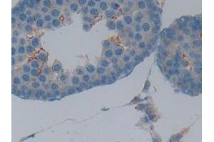 Detection of CSPG5 in Rat Testis Tissue using Polyclonal Antibody to Chondroitin Sulfate Proteoglycan 5 (CSPG5)