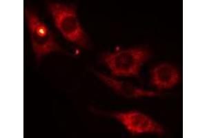 ABIN6275265 staining 293 cells by IF/ICC. (MYBPC1 anticorps  (Internal Region))