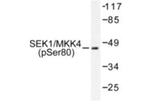 Image no. 1 for anti-Mitogen-Activated Protein Kinase Kinase 4 (MAP2K4) (pSer80) antibody (ABIN318113) (MAP2K4 anticorps  (pSer80))