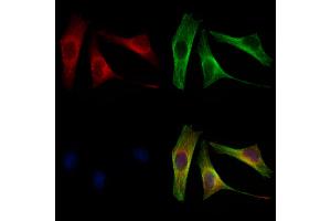 ABIN6264682 and ABIN6272949 staining 3 by IF/ICC. (RDH10 anticorps  (Internal Region))