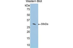 Detection of Recombinant PRDX4, Mouse using Polyclonal Antibody to Peroxiredoxin 4 (PRDX4)