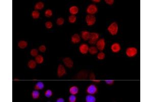 Immunofluorescence analysis of 293T cells using SLC25A17 Polyclonal Antibody at dilution of 1:100 (40x lens). (SLC25A17 anticorps)