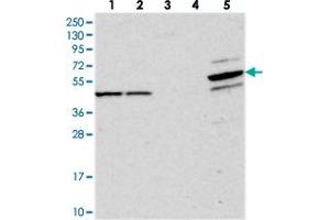 Western blot analysis of Lane 1: RT-4, Lane 2: U-251 MG, Lane 3: Human Plasma, Lane 4: Liver, Lane 5: Tonsil with PDE12 polyclonal antibody  at 1:250-1:500 dilution. (PDE12 anticorps)