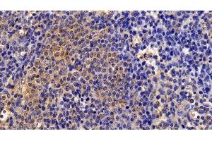 Detection of STAT1 in Human Spleen Tissue using Polyclonal Antibody to Signal Transducer And Activator Of Transcription 1 (STAT1)