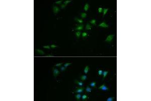 Immunofluorescence analysis of MCF7 cells using PPOX Polyclonal Antibody (PPOX anticorps)