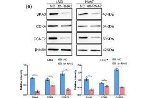 Downregulation of SKA3 affects the cell cycle in HCC cells. (SKA3 anticorps  (AA 201-300))