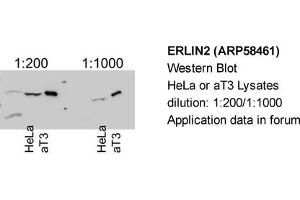 Western Blotting (WB) image for anti-ER Lipid Raft Associated 2 (ERLIN2) (Middle Region) antibody (ABIN406694) (ERLIN2 anticorps  (Middle Region))