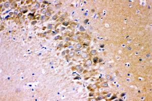 Anti- GRIA1 antibody, IHC(P) IHC(P): Rat Brain Tissue