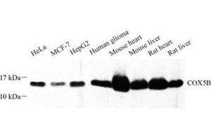 Western blot analysis of COX5B (ABIN7073665) at dilution of 1: 500 (COX5B anticorps)