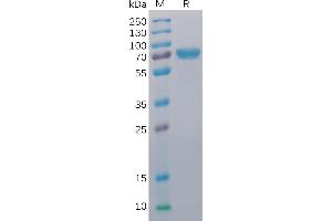 Human CD40 Protein, mFc-His Tag on SDS-PAGE under reducing condition.