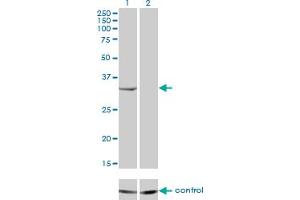 Western blot analysis of RNASEH2A over-expressed 293 cell line, cotransfected with RNASEH2A Validated Chimera RNAi (Lane 2) or non-transfected control (Lane 1). (RNASEH2A anticorps  (AA 1-299))