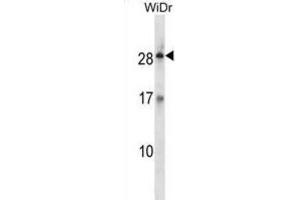 Western Blotting (WB) image for anti-Kallikrein-Related Peptidase 12 (KLK12) antibody (ABIN2998366) (Kallikrein 12 anticorps)