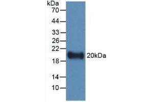 Detection of Recombinant IL19, Human using Monoclonal Antibody to Interleukin 19 (IL19)