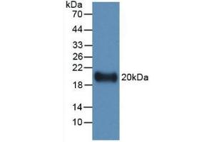 Detection of Recombinant IL19, Human using Monoclonal Antibody to Interleukin 19 (IL19) (IL-19 anticorps  (AA 25-177))
