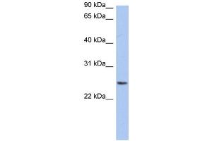 WB Suggested Anti-NRSN2 Antibody Titration:  0. (NRSN2 anticorps  (Middle Region))