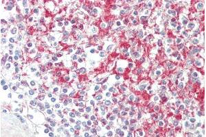 ABIN1781962 (5µg/ml) staining of paraffin embedded Human Spleen. (ADAM19 anticorps  (Internal Region))