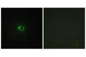 Immunofluorescence analysis of COS-7 cells, using Collagen XII α1 antibody.