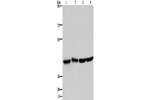 Western Blotting (WB) image for anti-Developmentally Regulated GTP Binding Protein 1 (DRG1) antibody (ABIN2423329) (DRG1 anticorps)