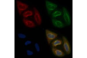 AWAT2 Mouse Monoclonal Antibody staining Hela cells by IF/ICC. (AWAT2 anticorps  (Internal Region))