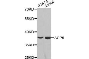 Western blot analysis of extracts of various cell lines, using ACP5 antibody. (ACP5 anticorps  (AA 76-325))