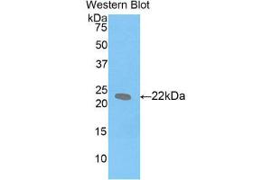 Western Blotting (WB) image for anti-Leukemia Inhibitory Factor (LIF) (AA 25-203) antibody (ABIN1859654) (LIF anticorps  (AA 25-203))