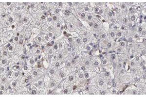 ABIN6266882 at 1/100 staining human liver tissue sections by IHC-P.