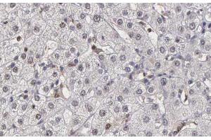 ABIN6266882 at 1/100 staining human liver tissue sections by IHC-P. (DNAJB1 anticorps  (C-Term))