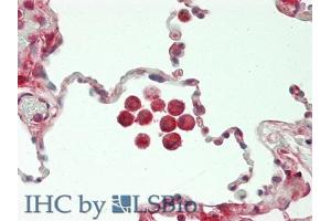 Figure. (CHI3L1 anticorps  (AA 112-377))