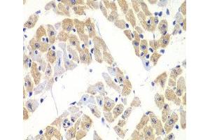 Immunohistochemistry of paraffin-embedded Mouse heart using ELF3 Polyclonal Antibody at dilution of 1:100 (40x lens).