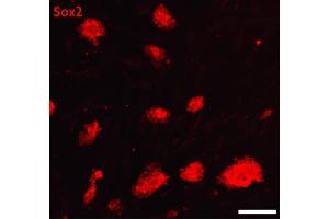 Sox2 antibody (pAb) tested by Immunofluorescence. (SOX2 anticorps  (C-Term))