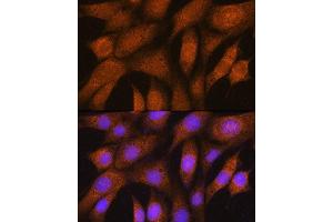 Immunofluorescence analysis of NIH/3T3 cells using GSTT2B Rabbit pAb (ABIN7267450) at dilution of 1:100. (GSTT2B anticorps  (AA 115-244))