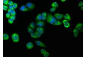 Immunofluorescence staining of Hela cells with ABIN7139839 at 1:166, counter-stained with DAPI. (Foxo6 anticorps  (AA 211-218))