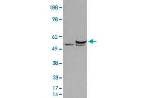 HEK293 overexpressing human DDX6 and probed with DDX6 polyclonal antibody  (mock transfection in first lane), tested by Origene. (DDX6 anticorps)