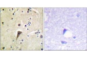 Immunohistochemistry analysis of paraffin-embedded human brain, using FAK (Phospho-Tyr397) Antibody.