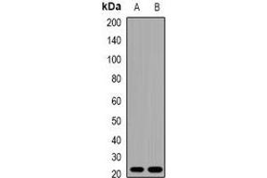 Western blot analysis of TNNI2 expression in mouse skeletal muscle (A), rat skeletal muscle (B) whole cell lysates. (TNNI2 anticorps)