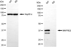 Western blotting analysis using MAPRE2 antibody (ABIN7799411).