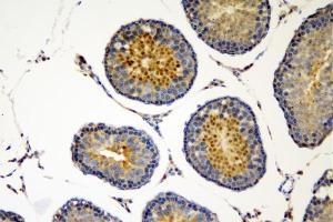 IHC analysis of SOX6 using anti-SOX6 antibody (ABIN7603012). (SOX6 anticorps  (Middle Region))