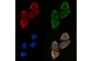 ABIN6258699 and ABIN6275026 staining Hela cells(30 min of UV treatment) by IF/ICC. (BEND4 anticorps  (Internal Region))