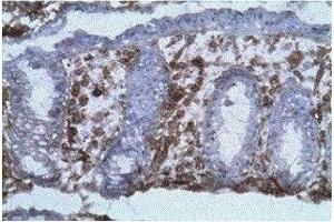 Labelling on frozen section (acetone fixed) of human colic mucosa with B-B20 diluted at 1:100 (background coloration by hematoxylin). (CD40 anticorps)