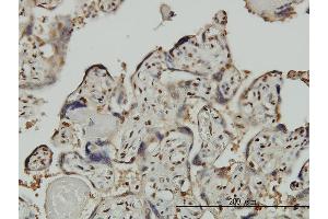 Immunoperoxidase of monoclonal antibody to GTF2I on formalin-fixed paraffin-embedded human placenta.