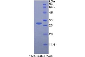 SDS-PAGE analysis of Rat Insulin Like Growth Factor 2 Receptor (IGF2R) Protein.