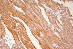 IHC analysis of Hsp20 using anti-Hsp20 antibody (ABIN5518920). (HSPB6 anticorps  (AA 73-123))