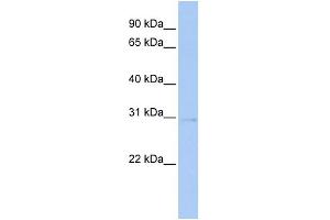 WB Suggested Anti-STK16 Antibody Titration:  0. (STK16 anticorps  (Middle Region))
